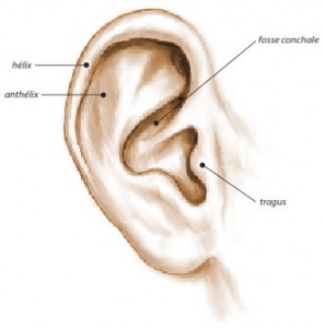 L'anatomie d'une oreille décollée porte sur la l'hypertrophie de la conque et/ou le défaut de plicature de l'anthélix