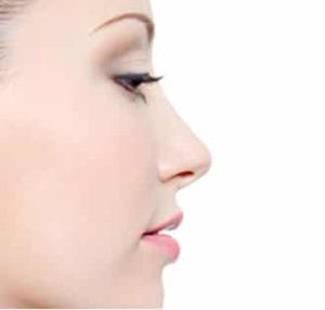 Rhinoplastie