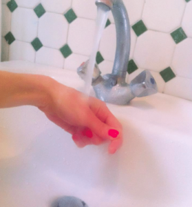 brulure-sous-eau-froide