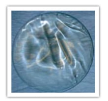prothese mammaire en silicone ronde