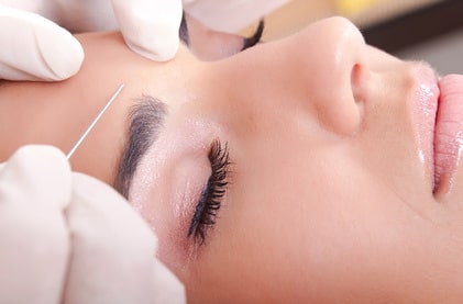 Injections de toxine botulique