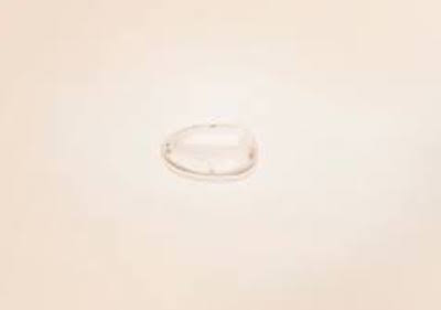 implant-menton-sebbin