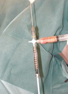 graisse-centrifugee-prete-injection