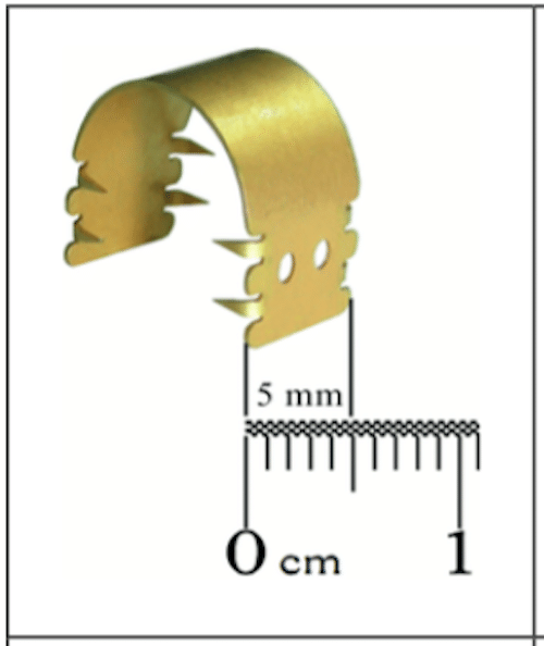Implant-Earfold®