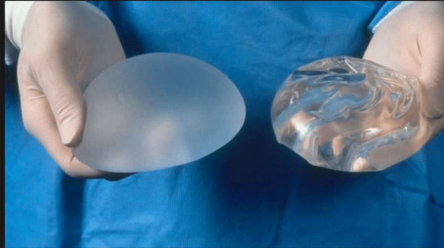 implant-mammaire-lisse-texturé