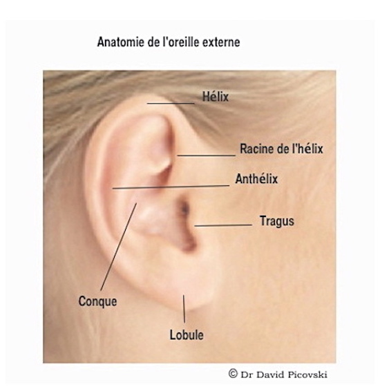 L'hypercorrection, une complication de l'otoplastie rare
