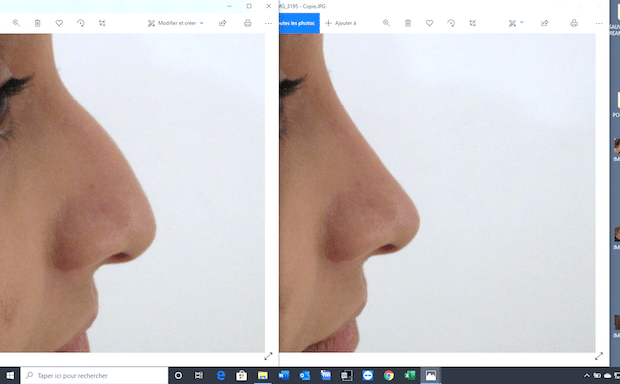 Exemple de morphing réalisé avant une rhinoplastie 
