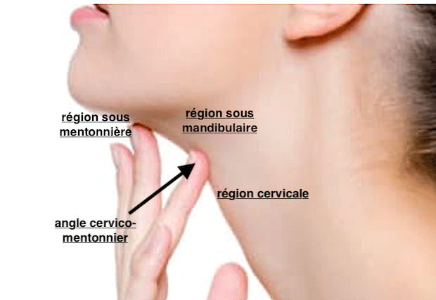 Régions du cou pouvant être traitées par liposuccion