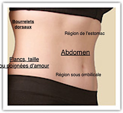 Zones anatomiques traitées par une chirurgie esthétique du ventre