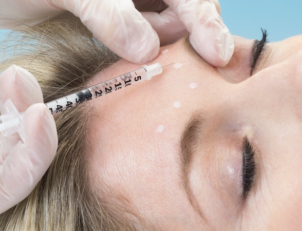 Injection de Botox au niveau des "5 points importants" de la ride du lion (glabellaire)