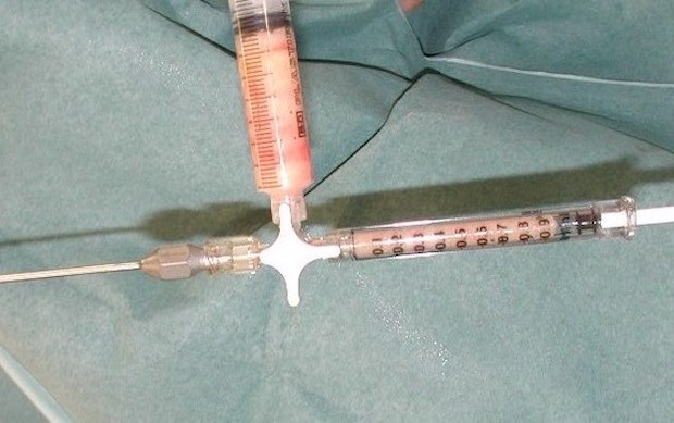 Graisse purifiée avant d'être disposée dans des seringues pour injections fines