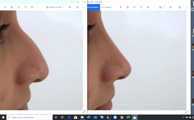 Exemple d'un morphing avant une correction esthétique du nez (rhinoplastie)
