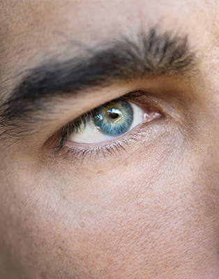 La blépharoplastie