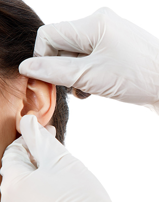 Recoller les oreilles : l'otoplastie